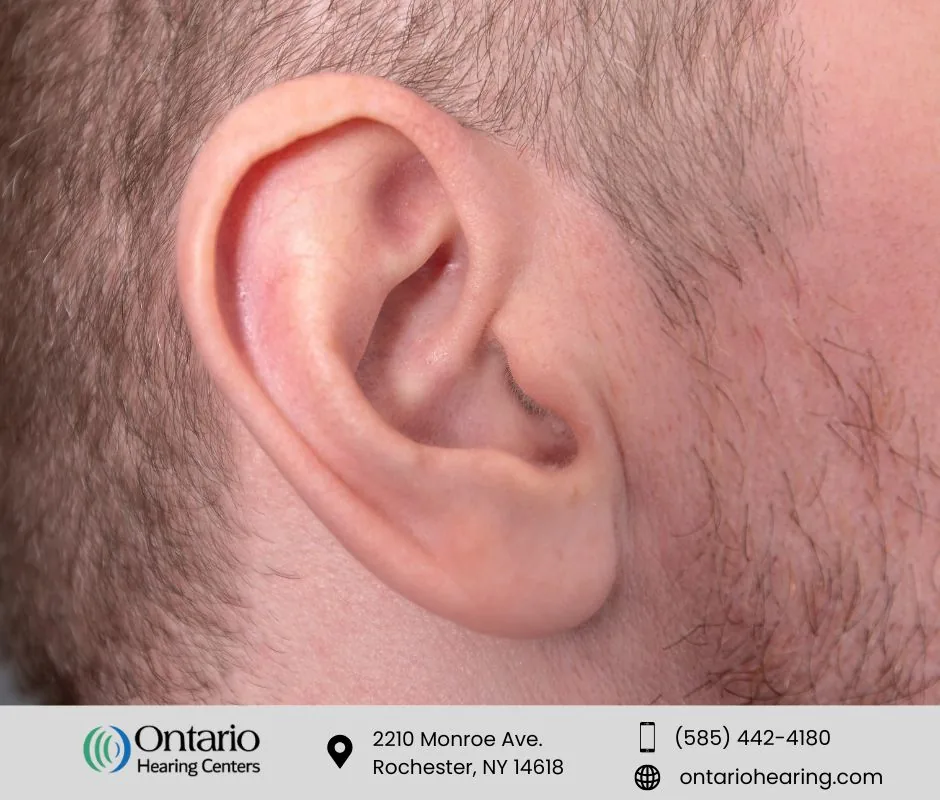 Close-up of man ear for ear wax removal article