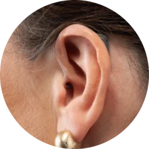 Open-ear hearing aids in Rochester, NY for a natural listening experience and all-day comfort.